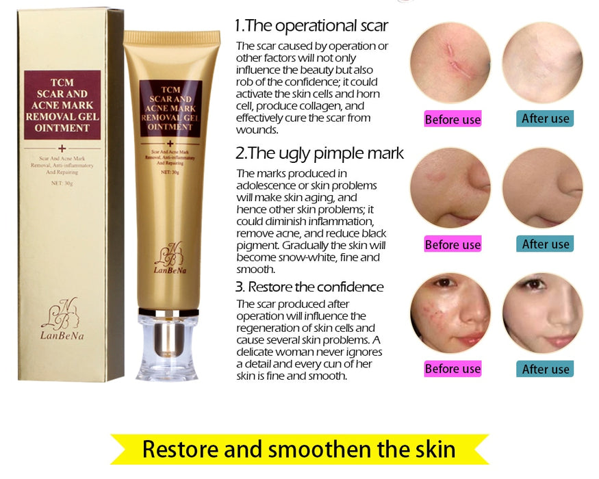 Acne Scar Remover cream - Acne Treatment, Shrink Pores Gel Bleaching Creams Whitening Moisturizing Face Cream Skin Care