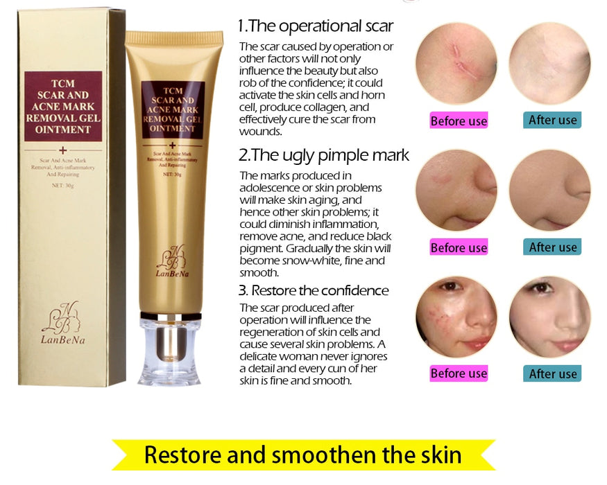 Acne Scar Remover cream - Acne Treatment, Shrink Pores Gel Bleaching Creams Whitening Moisturizing Face Cream Skin Care